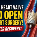 Transcatheter aortic valve replacement, TAVR, TAVR procedure, Aortic valve replacement, Transcatheter heart valve replacement